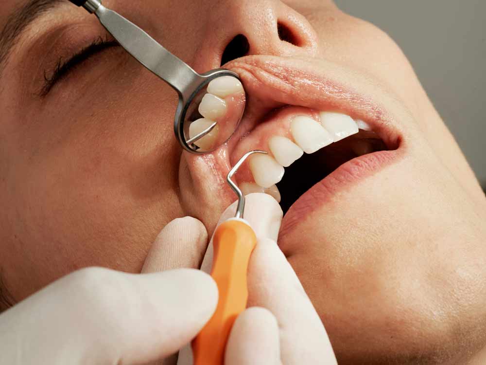 Emergency dental care in Jacksonville, Jacksonville Beach, Neptune Beach, and Atlantic Beach—dentist examining patient’s teeth with mirror and scaler, illustrating urgent treatment for severe tooth pain and the importance of quick access to professional dental services to prevent complications and restore oral health.