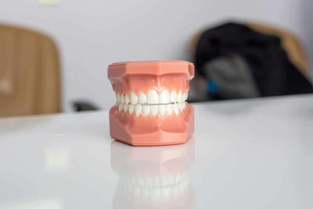 Dental implants vs. partial dentures comparison—model of human teeth and gums displayed on a table, representing common tooth replacement options that restore function, improve appearance, and help patients choose the best solution based on comfort, durability, and long-term oral health goals.